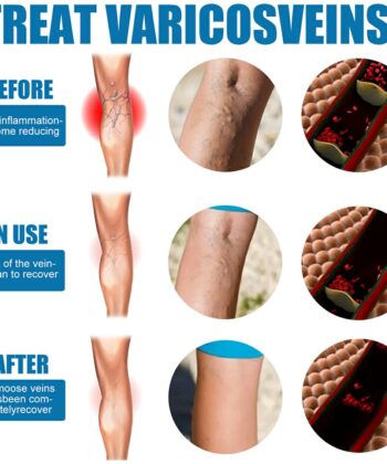 9b30b2a7e5342217e60514f0578bd5e8